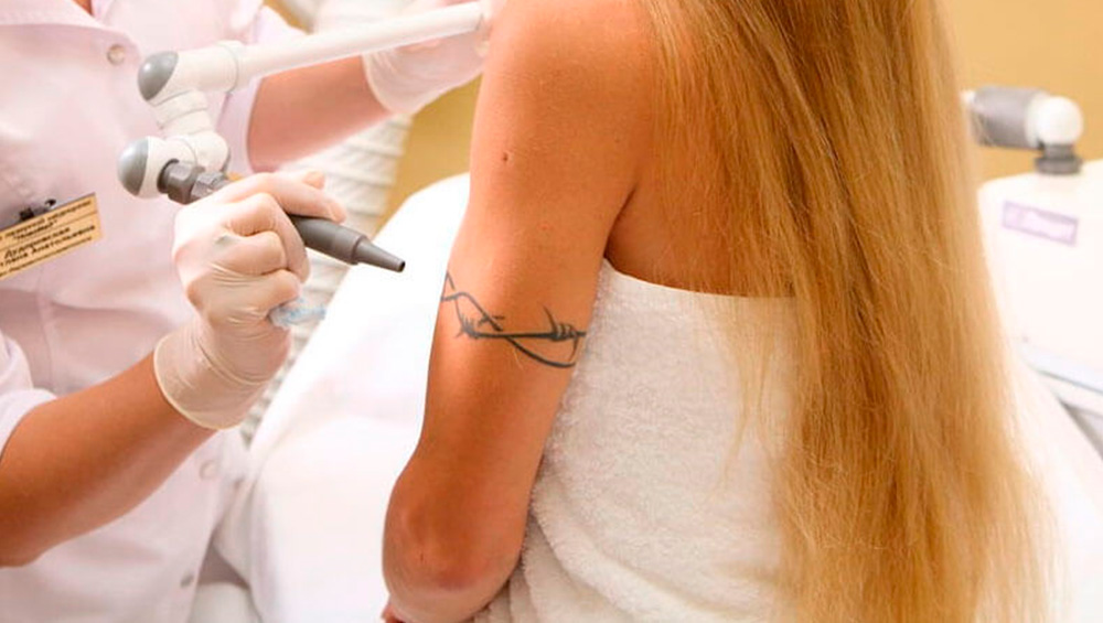 Как подготовиться к лазерному удалению татуировок: важные шаги перед процедурой.